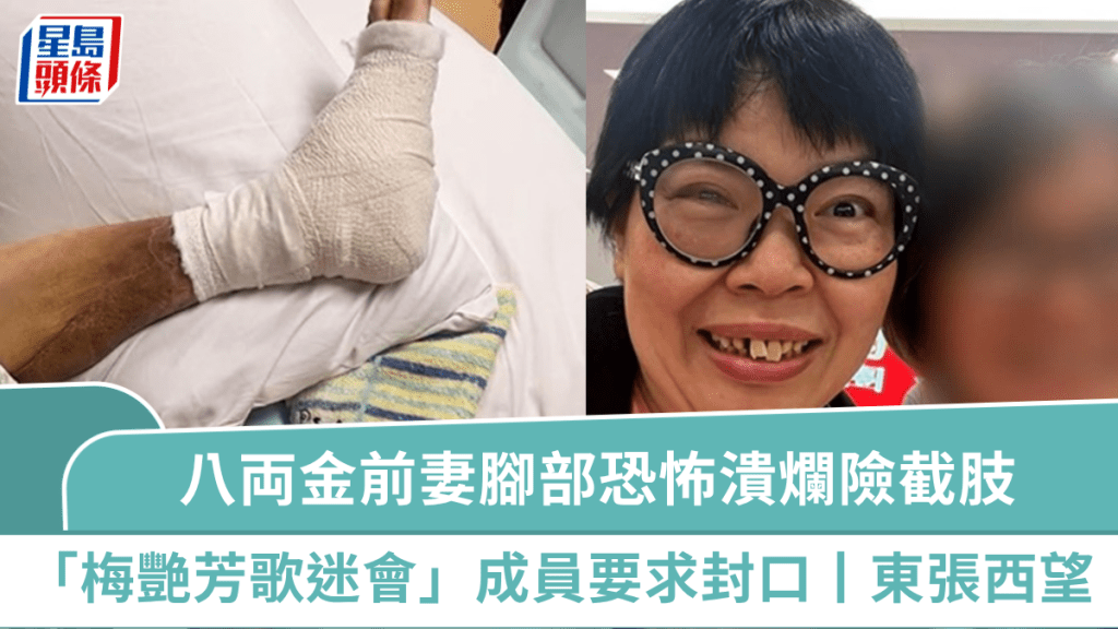 東張西望丨八両金前妻腳部恐怖潰爛險截肢 「梅艷芳歌迷會」成員阻撓採訪要求封口