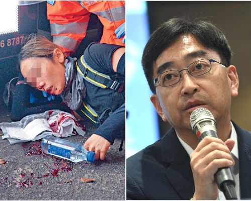 高永文一度稱女示威者遭彈珠傷眼,其後澄清不知傷勢哪方造成。