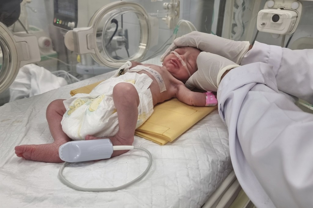 巴勒斯坦醫護人員對一名已死孕婦進行緊急剖腹，成功誕下這名女嬰。美聯社