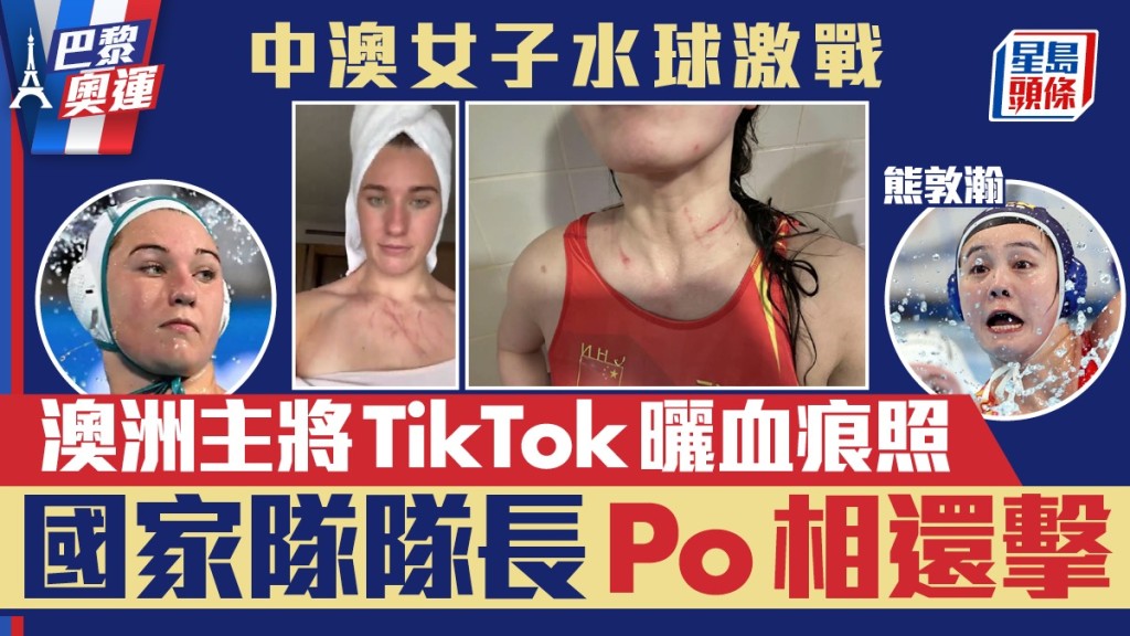 澳洲女水球代表曬出與中國隊賽後的血痕照，引發爭議。