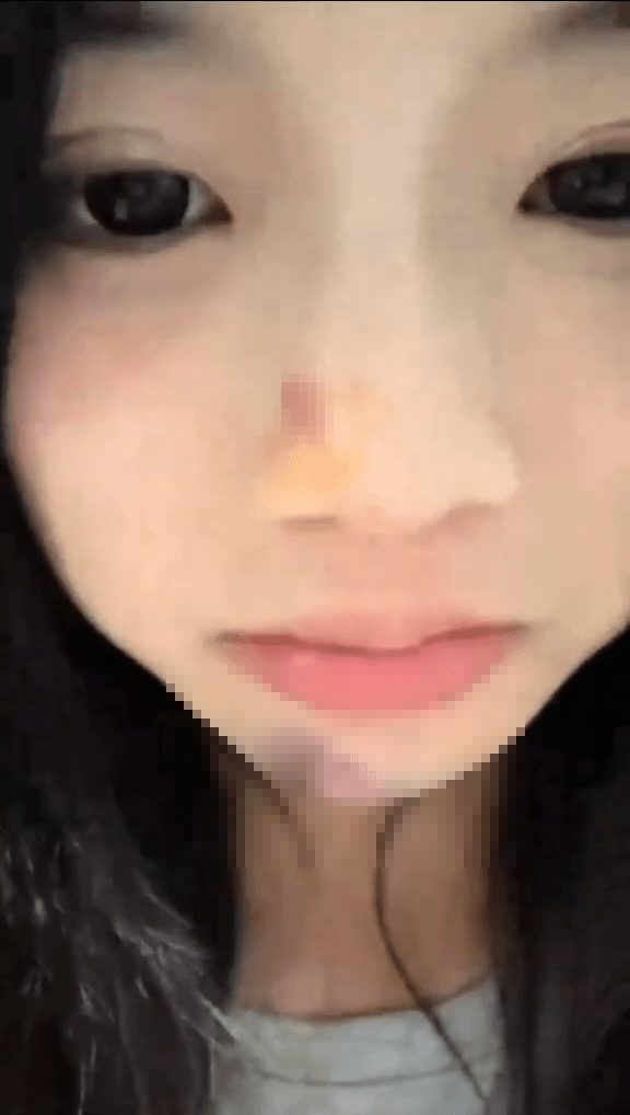 女遊客拍下玩「笨豬跳」被推下後的傷情。