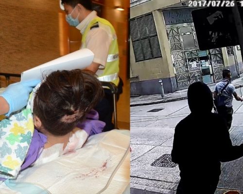 男事主被兩刀匪斬傷，後腦亦中刀。兩刀匪得手後逃之夭夭。
