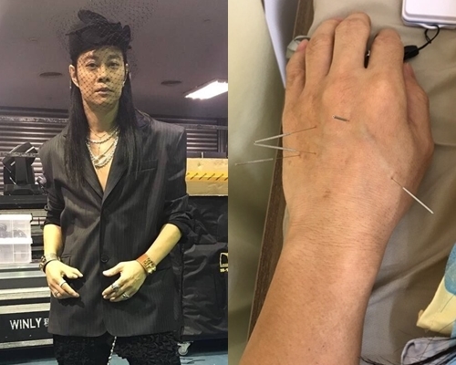 蔡一智再去針灸,尾龍骨傷患未痊癒。