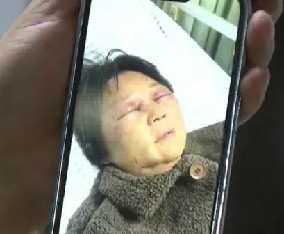 沈妇曾遭新抱打断四条肋骨。《钱塘老娘舅》 沈妇曾遭新抱打断四条肋骨。《钱塘老娘舅》