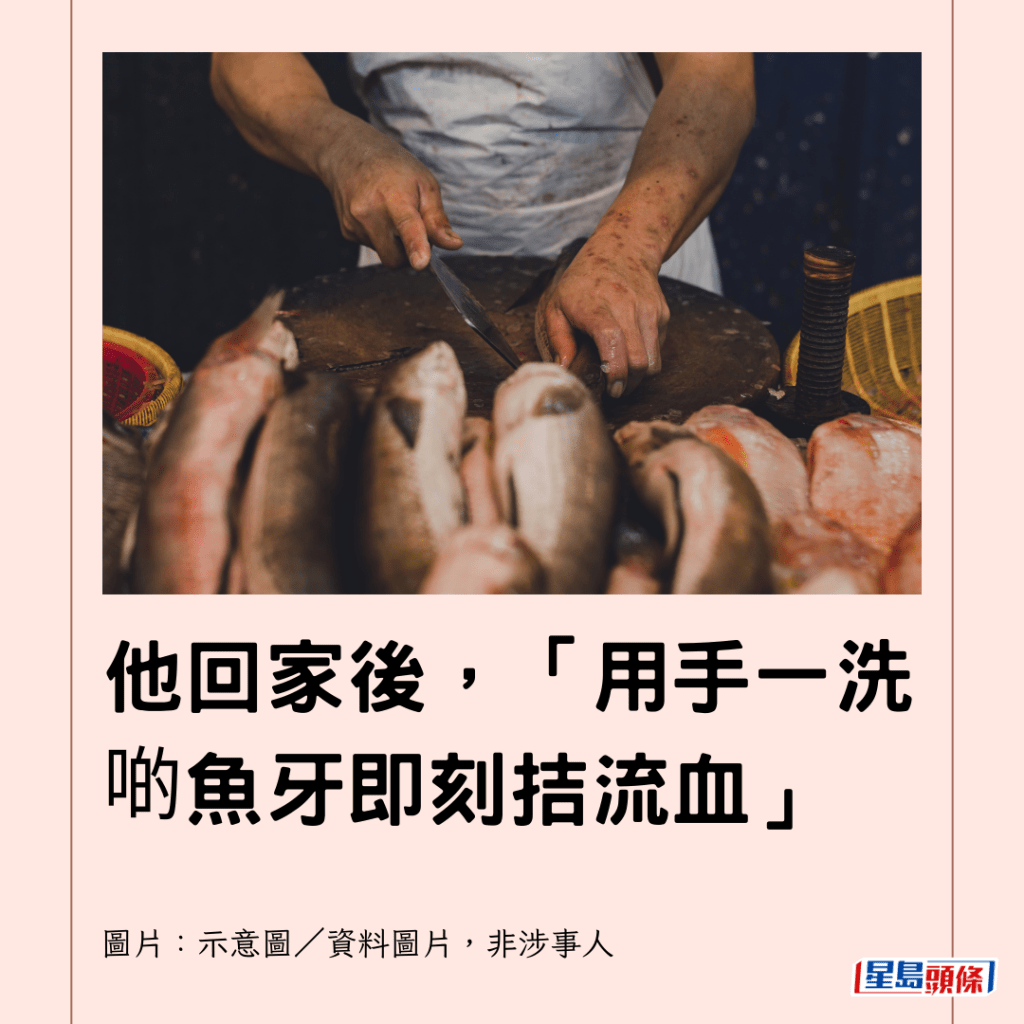  他回家後，「用手一洗啲魚牙即刻拮流血」