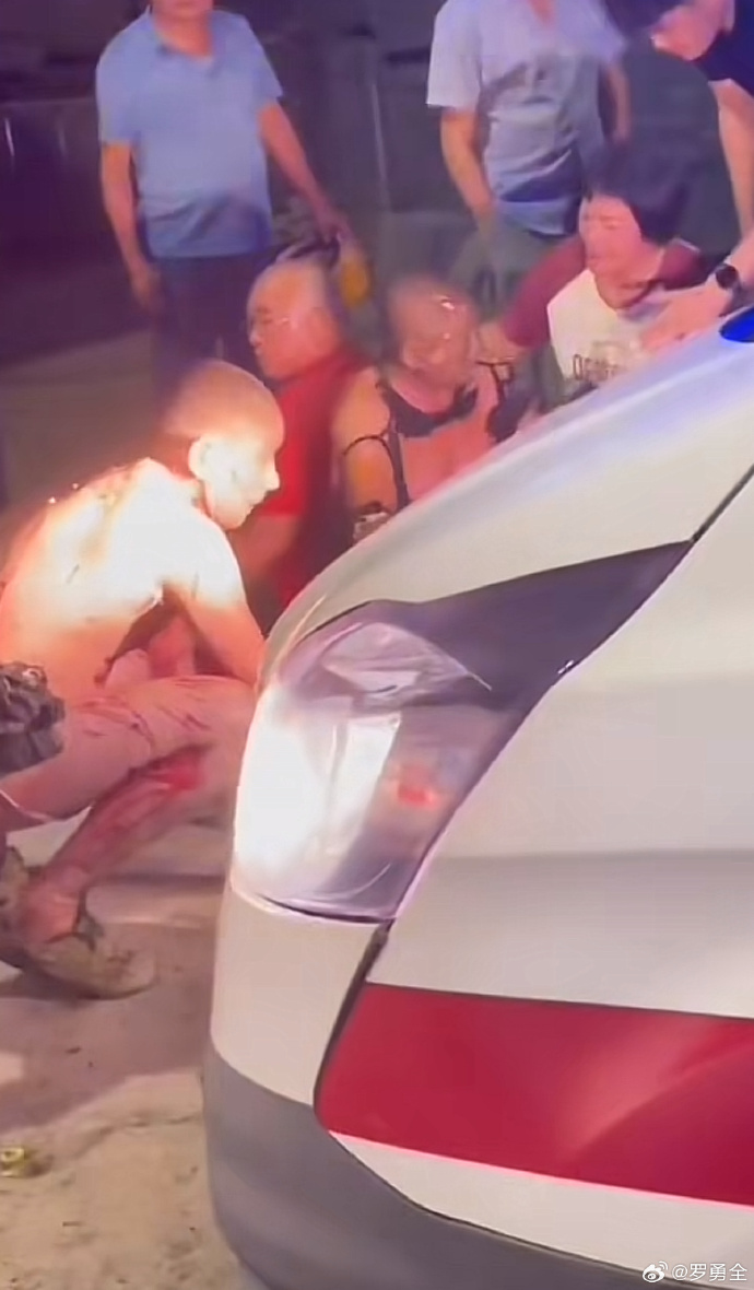現場有人衣服被燒光等待救治。 現場有人衣服被燒光等待救治。
