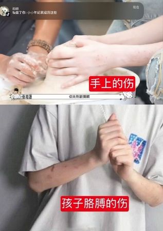 又有眼利網民發現魏子宸平時作為練習生公開的影片中，手上竟有許多不明傷口。