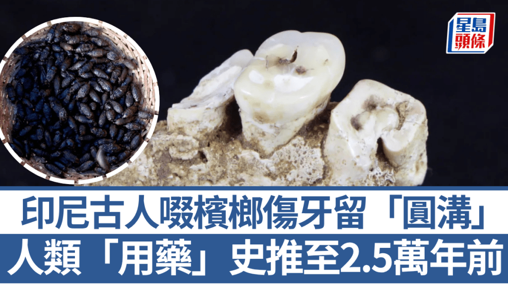 印尼古人啜槟榔伤牙留「圆沟」 人类「用药」史推至2.5万年前