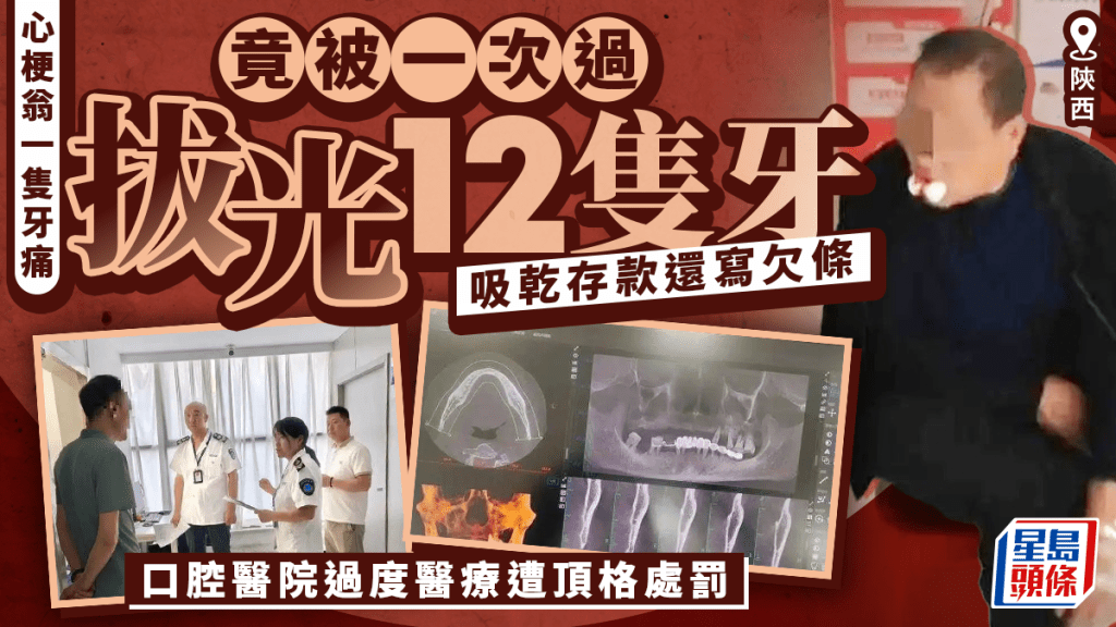 過度醫療︱陝西心梗翁遭一次拔光全口牙吸乾存款  口腔醫院遭頂格處罰