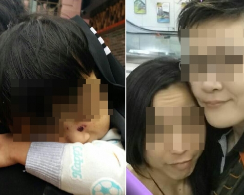 根據女童家人提供的照片可見，女童被接回時陷入半昏迷狀態，她面部有傷痕。