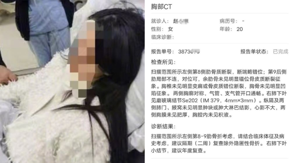 浙江女生遭男生抽凳致骨折,女生父母竟沒有支持她維權,反怪她讓人笑話。