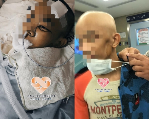 小宇7歲患上惡性橫紋肌肉瘤,至今已第3次復發。社團法人愛的延續公益協會FB