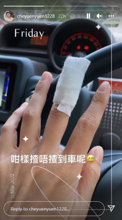 車婉婉手指受傷。
