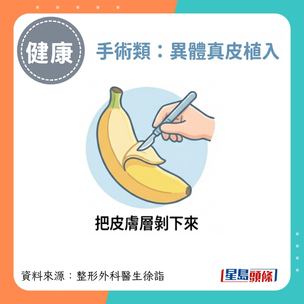 把皮肤层剥下来，在海绵体外面多加一层有延展性的异体真皮片，如同装上“钢筋”