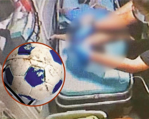 男童堅持21天後因缺氧性腦病變,恐無法復原,家屬只好決定忍痛拔喉。網圖