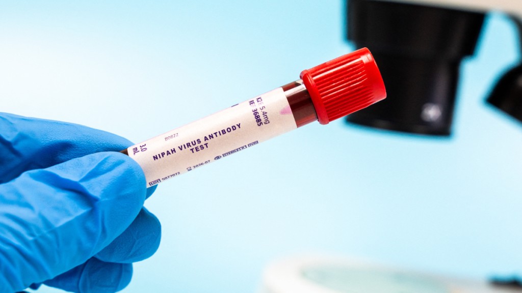 尼帕病毒暫時無藥可治。法新社