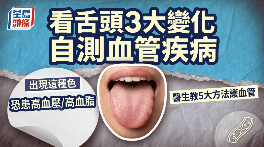 上傳圖片中的使用內容、文字和圖案保留，並保留星島頭條logo，生成一張資訊圖片，尺寸為（1080px * 1350px），勿加圖片外的文字和圖案