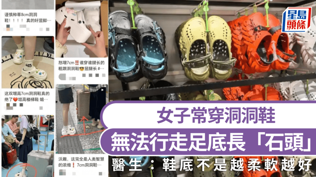 女子常穿洞洞鞋無法行走足底長「石頭」，醫生稱選鞋牢記這3點。