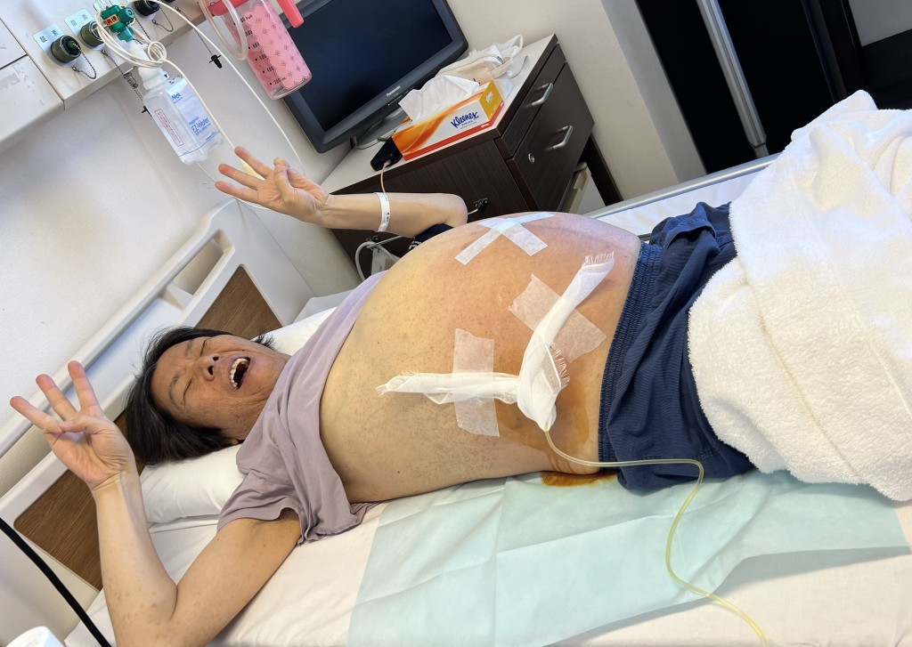 日本網紅Kimbae去年9月一度緊急送院搶救。