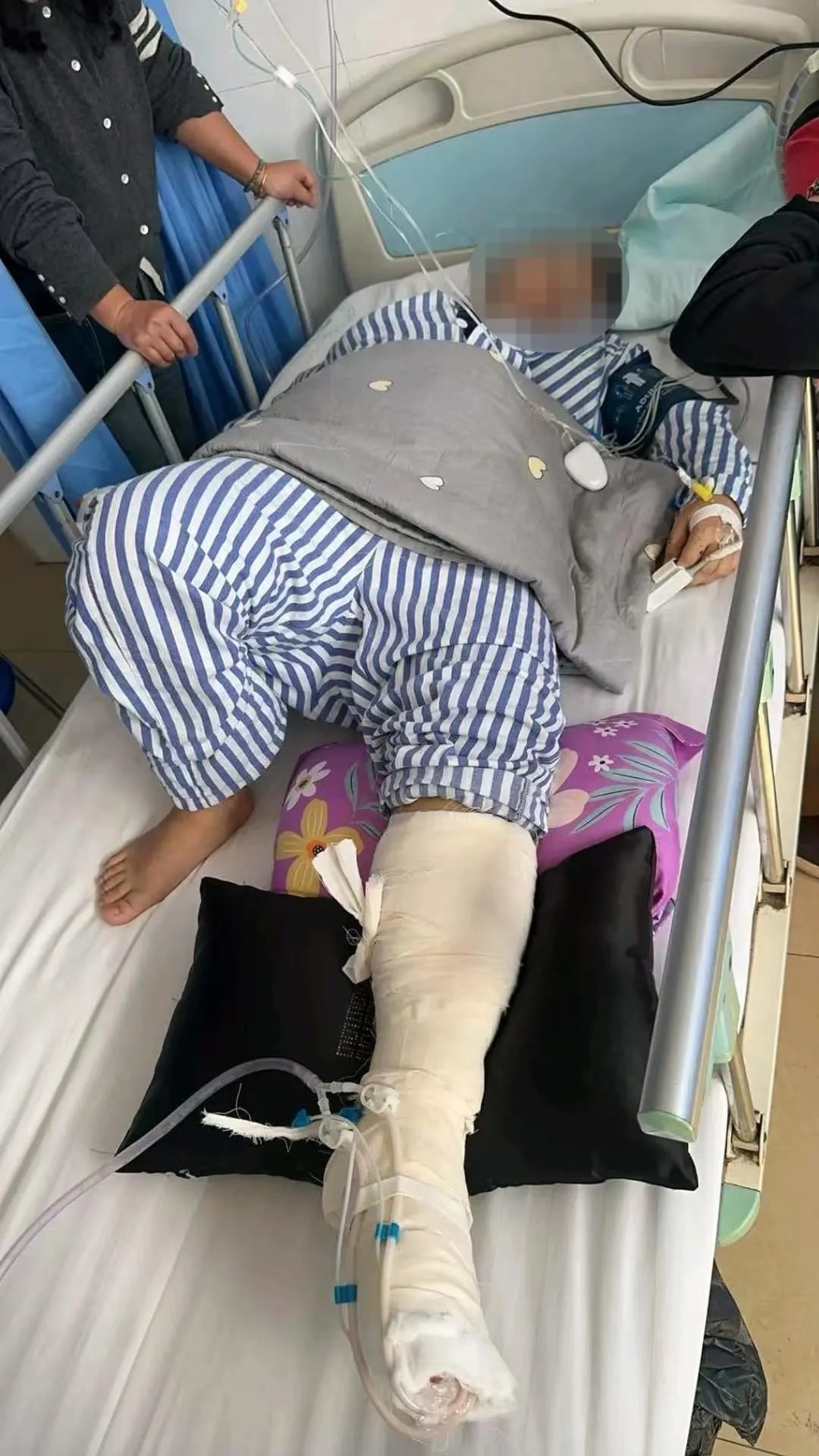 被电击女子一度送入ICU抢救。