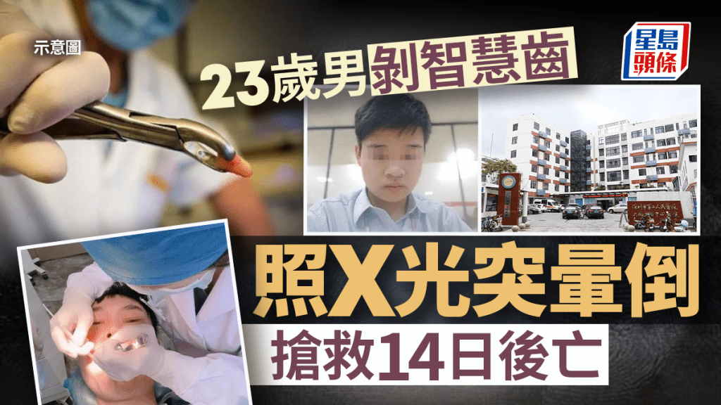 深圳23歲汽車工程師剝智慧牙後顱內出血 開腦搶救14日後亡