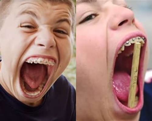 约翰逊的超大口。网上图片