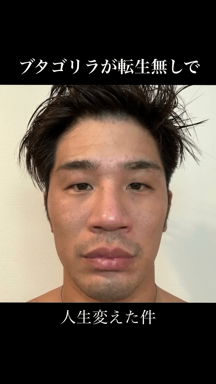 日丑男被骂“猪狒狒”饱受欺凌,狂操肌兼整容逆袭成“神户型男”。 日丑男被骂“猪狒狒”饱受欺凌,狂操肌兼整容逆袭成“神户型男”。