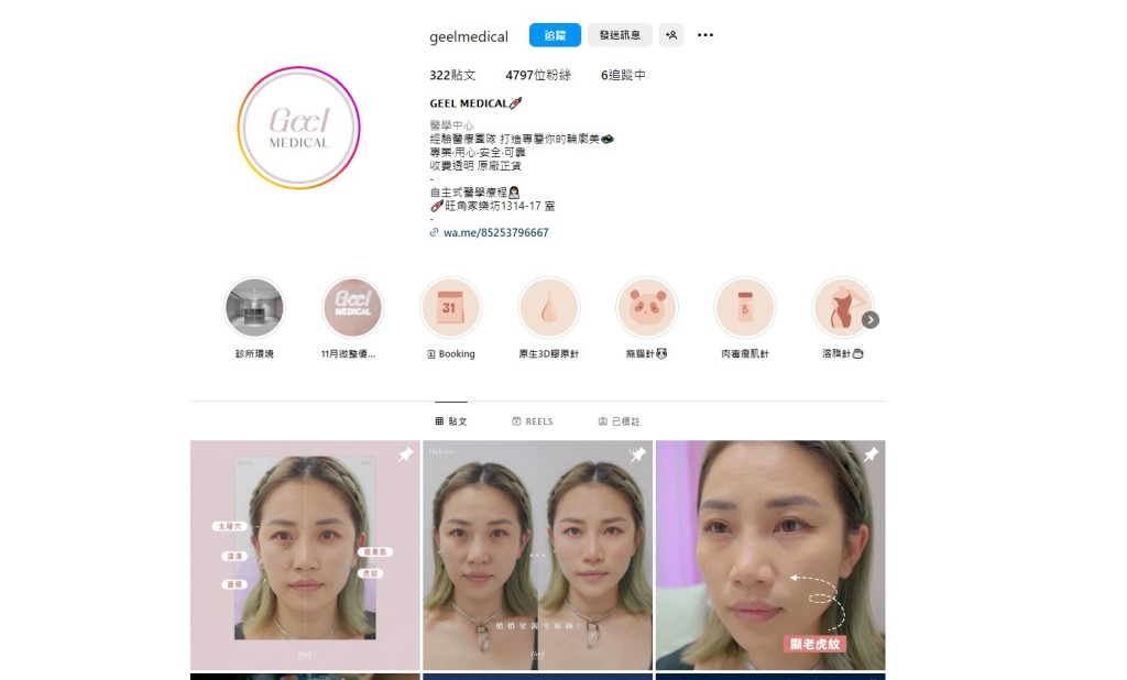 一名女子在“GEEL MEDICAL”接受胶原蛋白增生注射后感染脓肿分枝杆菌。GEEL MEDICAL instagram截图