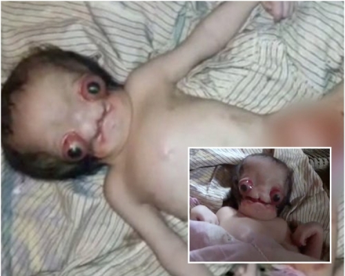 村民形容男嬰像外星人。網圖