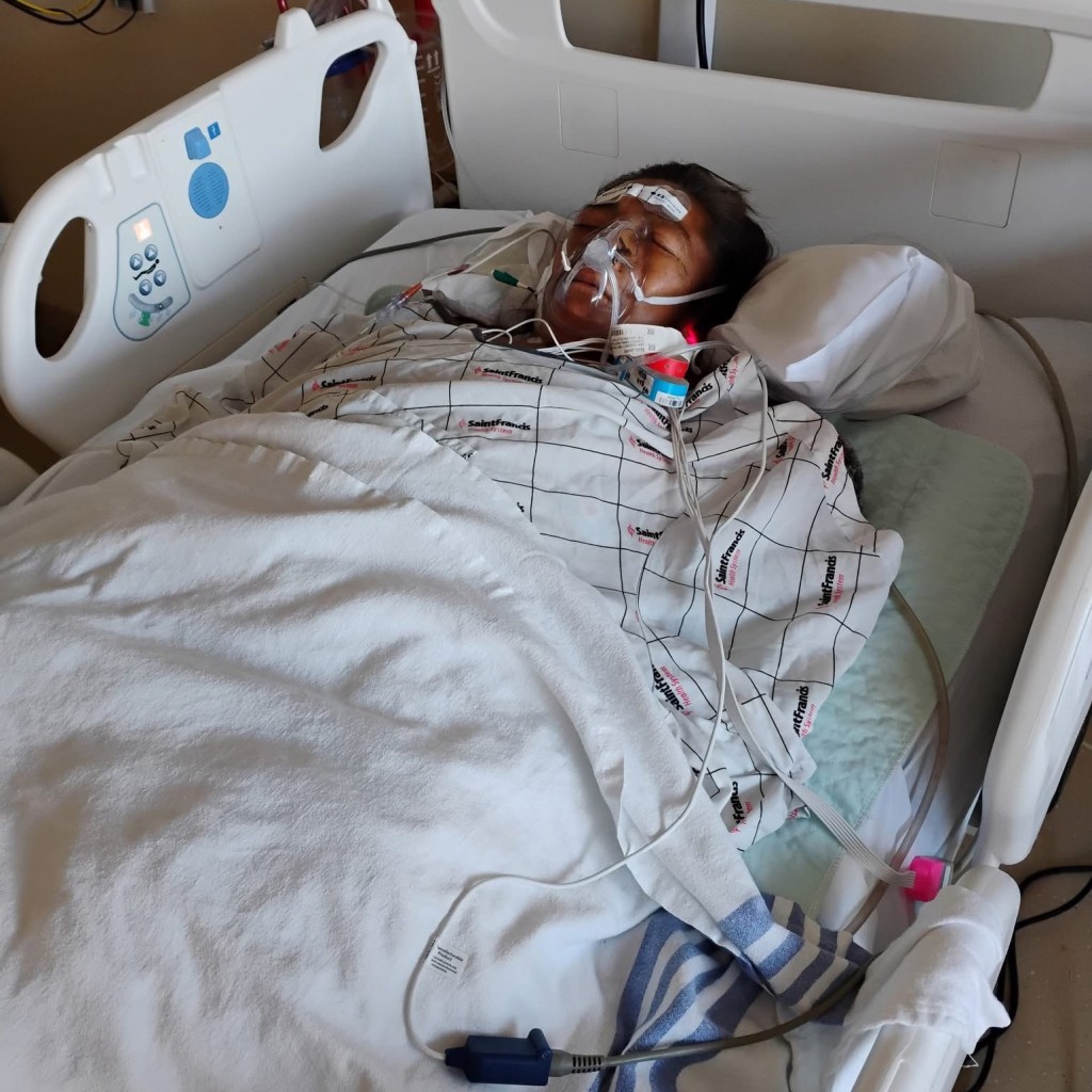 史考特（Janelle Scott）遭比特犬咬至重傷，須慘截四肢保命。 GoFundMe