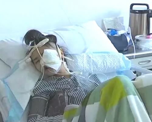 貴州少女因拔光牙齒多年來遭毀容。網上圖片