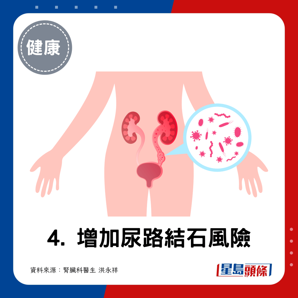 4. 增加尿路結石風險：