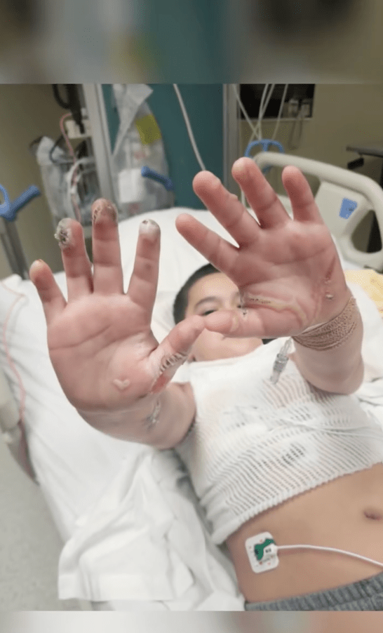 Lorenzo Lopez身上被電流灼傷的疤痕令人悚目驚心。