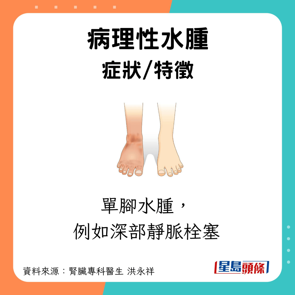 特徵：可能是單腳水腫