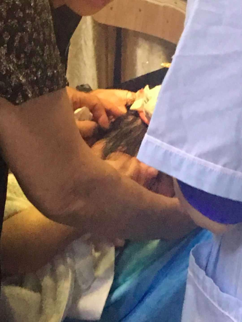 女童的頭部被咬下一個3厘米左右的傷口。(網圖)