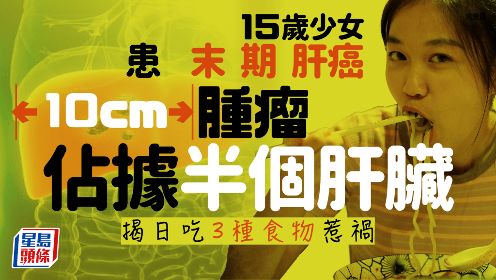15歲少女患末期肝癌 10cm腫瘤佔據半個肝臟 揭日吃3種食物惹禍