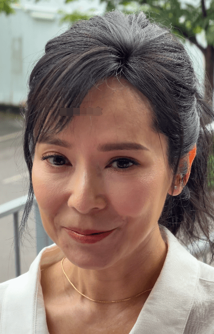 郭羨妮被指上唇極薄有異樣。