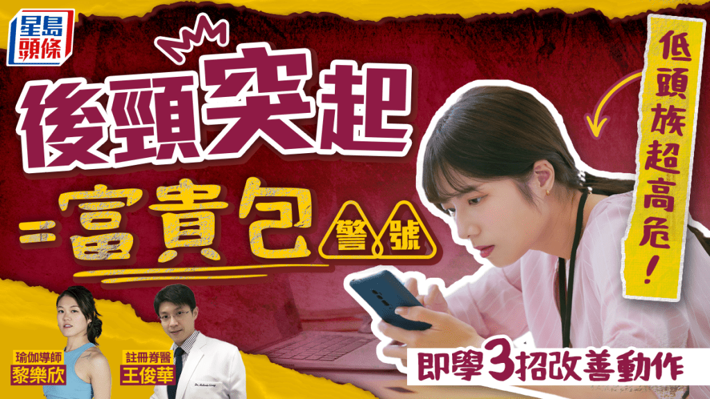 低头族超高危！后颈突起是「富贵包」警号 专家教3招改善动作