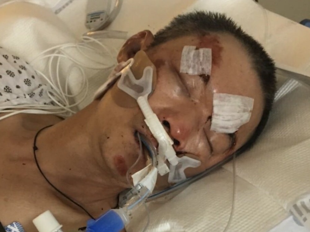 受害男子腦部受創及骨折,現時情況危殆。