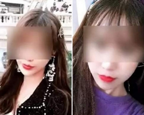 31歲深圳女子隆鼻手術後,智力水平竟降至1歲嬰兒。