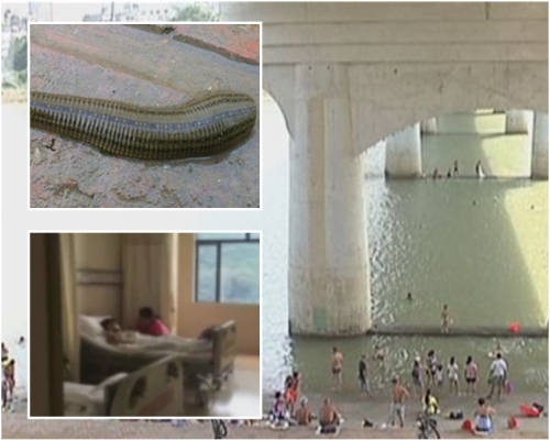 廣西8歲女童只穿內褲下河游泳，致被水蛭鑽進陰道大出血。(網圖)