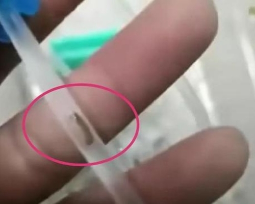 輸液管中的蟲狀物體。網圖