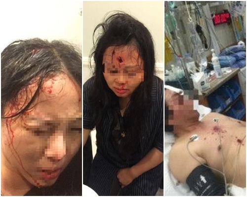 3人中槍受傷送院治理，幸無生命危險。網圖