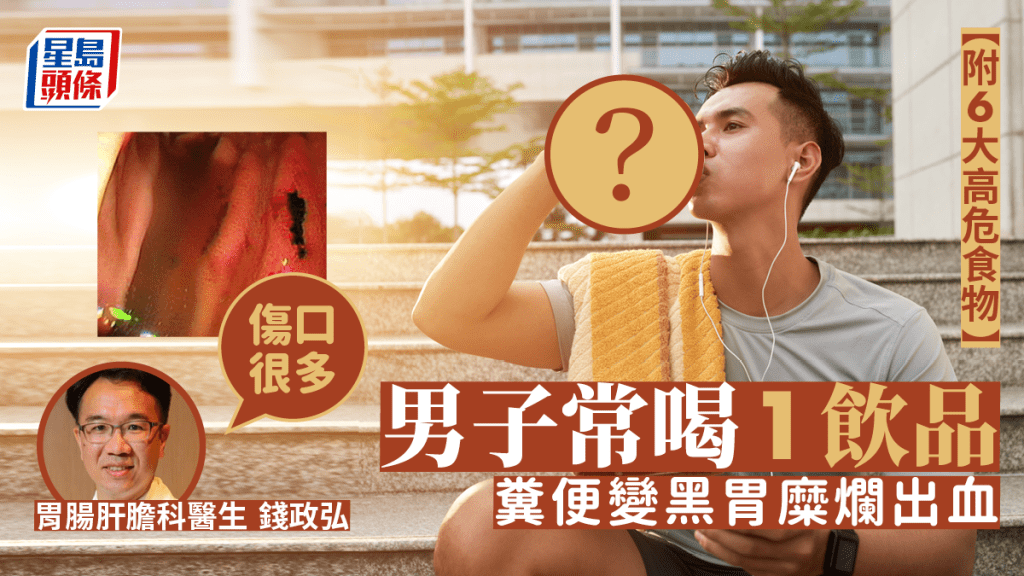 男子常喝1款飲品導致胃潰瘍糜爛出血