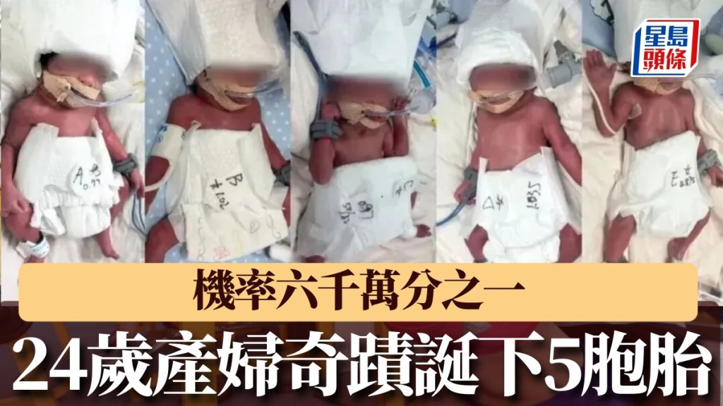 24歲新疆產婦誕5胞胎，機率僅六千萬分之一。