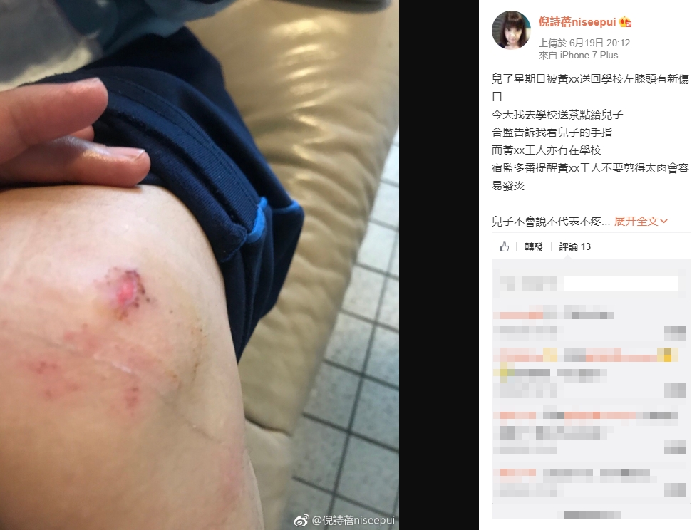 倪詩蓓指責「黃XX」送兒子回學校後現新傷口。(網圖)