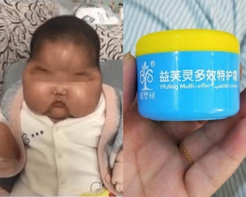 歐艾嬰童健康護理用品有限公司生產的抑菌霜因含類固醇,被吊銷牌照。