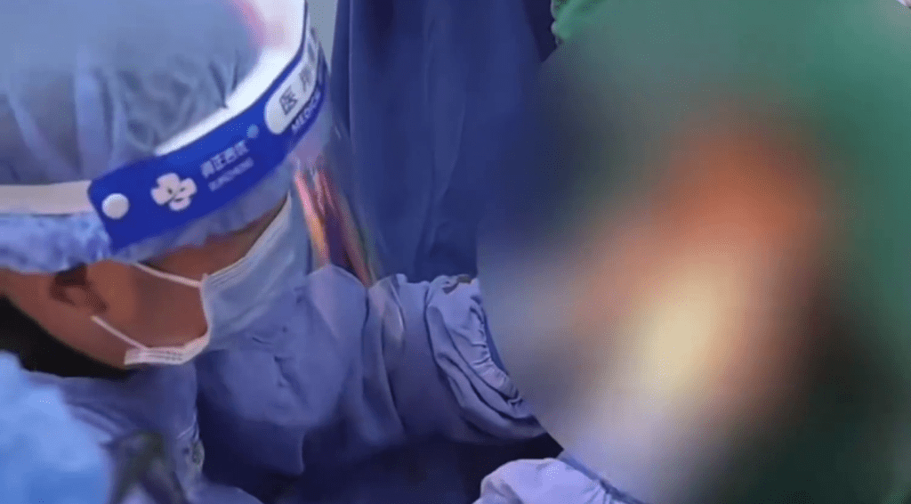 医生尝试多种手法未能完全取出番薯。 医生尝试多种手法未能完全取出番薯。