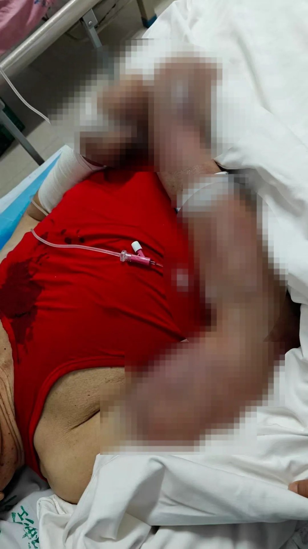 马女士父亲遭安老院室友狂殴两小时。红星新闻