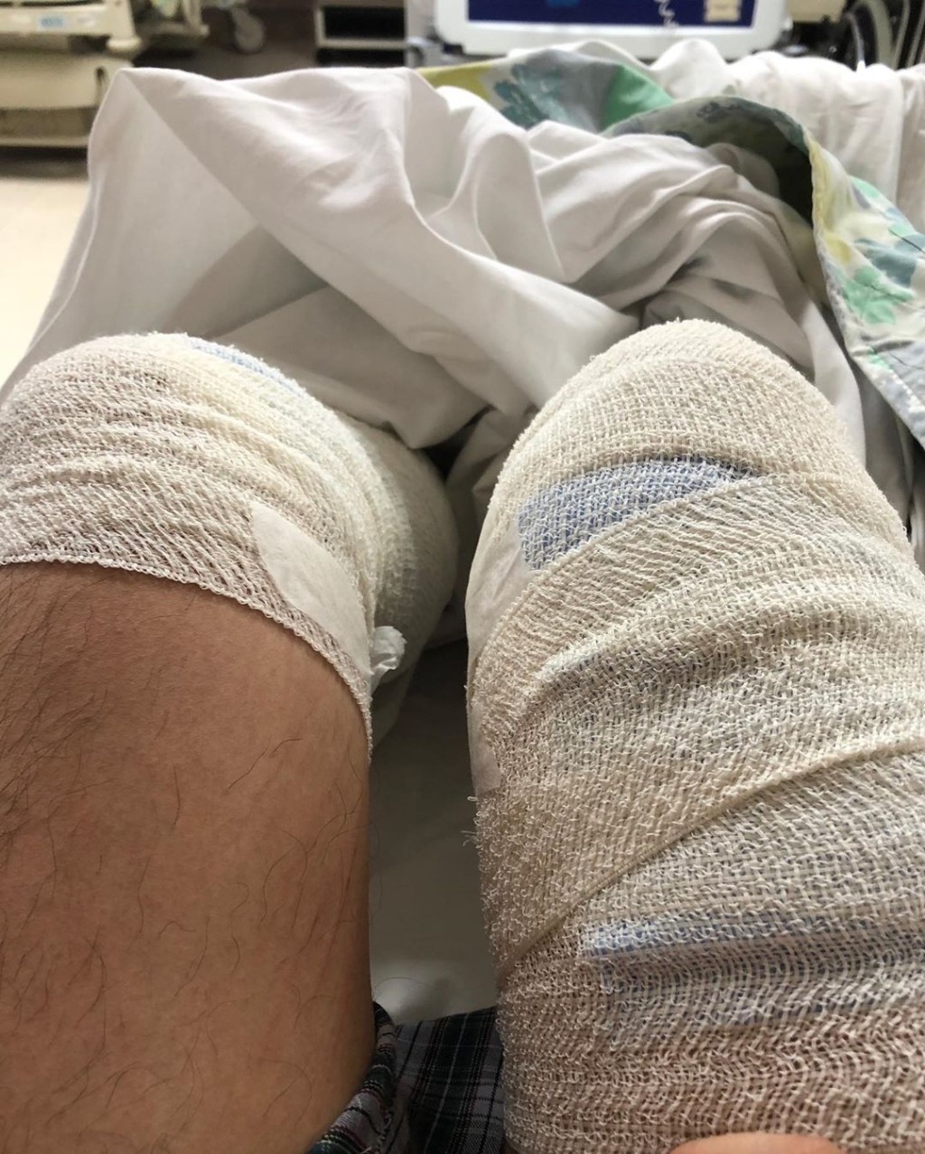 當時林奕匡雙腳都傷得唔起咁㗎！